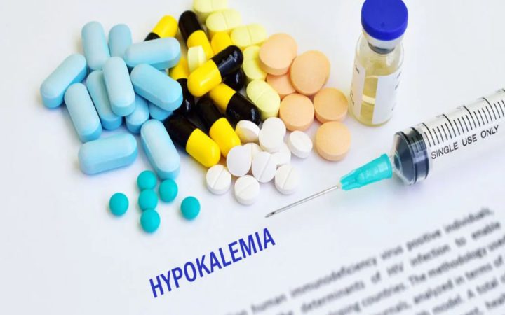 Hipokalemi (Potasyum Eksikliği) Nedir?