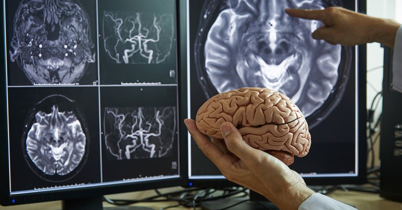 Beyin Tarama Teknolojileri