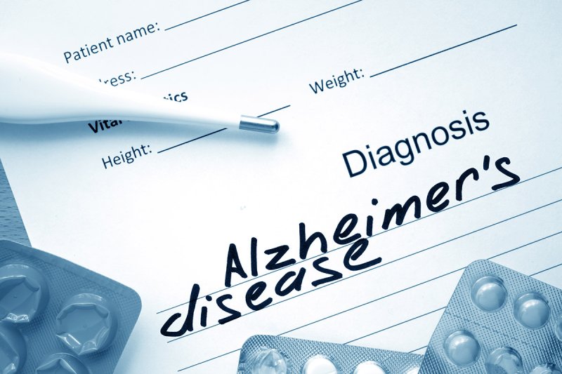Alzheimer Hastalığında Tedavi 