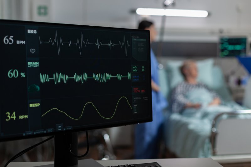 EKG