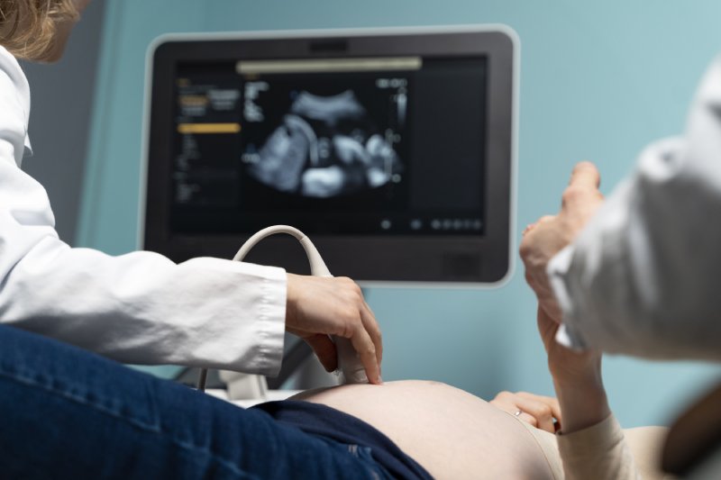 Ultrasonografi