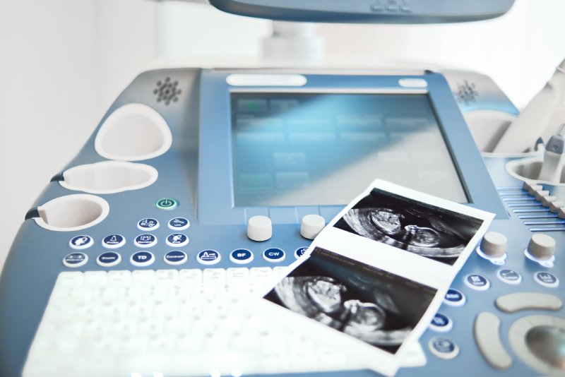 Ultrasonografinin Çalışma Prensibi