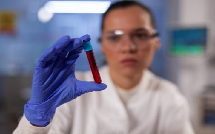 Kandaki Ferritin Seviyesi Neyi Gösterir?